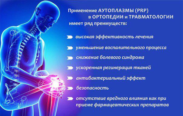 PRP-терапия. Современный метод лечения травм и повреждений