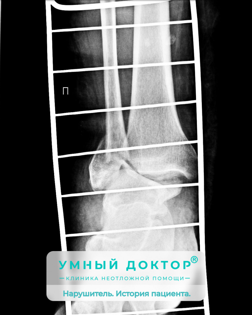 Почему нужно слушать доктора или история пациента Н.