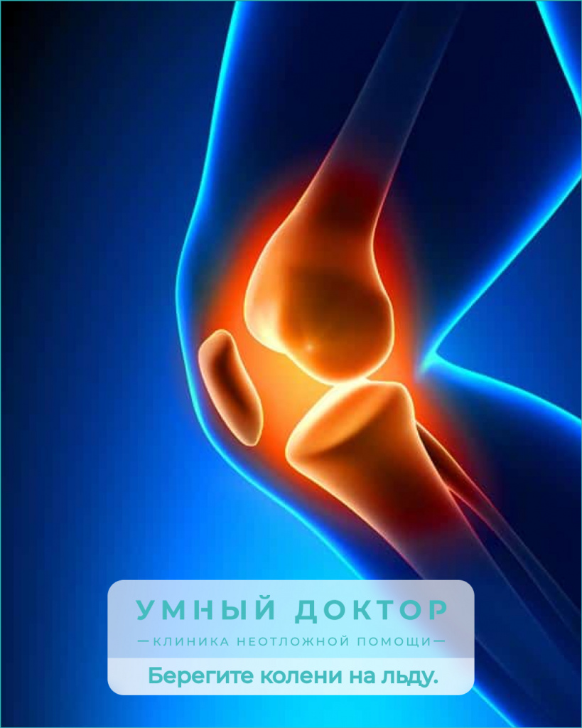Берегите свои колени: зимние переломы надколенника и их лечение в "Умном докторе"