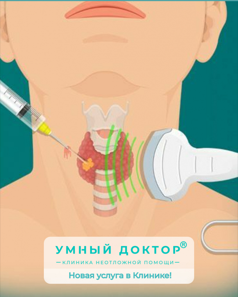 Новая услуга в Клинике! Пункция щитовидной железы под УЗИ-контролем. Новая услуга в Клинике! Пункция щитовидной железы под УЗИ-контролем.