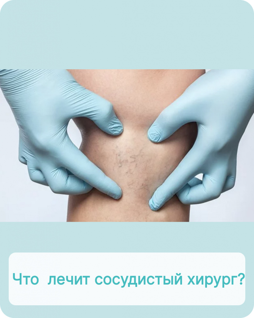 Что лечит сосудистый хирург?